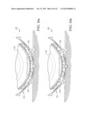 WHEEL AND TIRE ASSEMBLY diagram and image