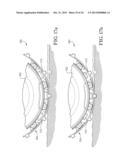 WHEEL AND TIRE ASSEMBLY diagram and image