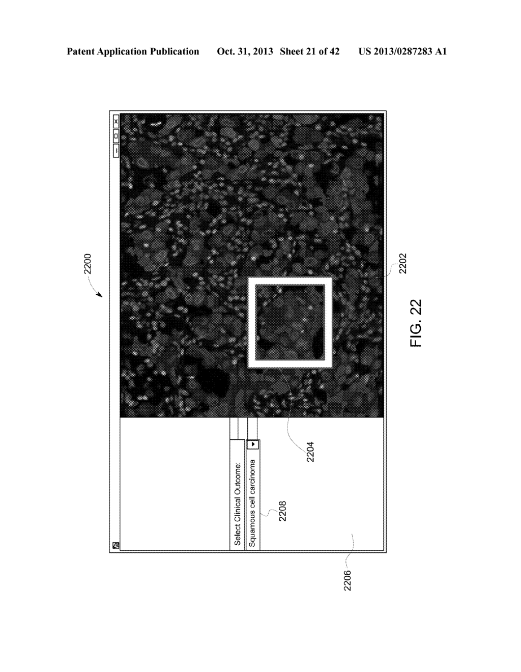 SYSTEMS AND METHODS FOR PERFORMING QUALITY REVIEW SCORING OF BIOMARKERS     AND IMAGE ANALYSIS METHODS FOR BIOLOGICAL TISSUE - diagram, schematic, and image 22