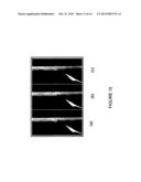 METHOD, AN APPARATUS AND A COMPUTER PROGRAM PRODUCT FOR DEINTERLACING AN     IMAGE HAVING A PLURALITY OF PIXELS diagram and image