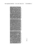 SOMATOSTATIN RECEPTOR-BASED CANCER THERAPY diagram and image