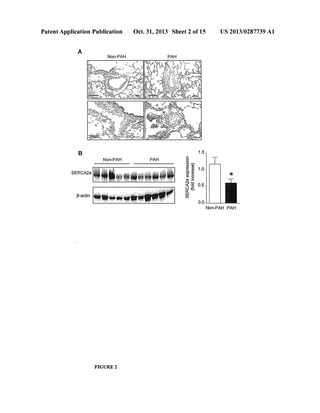 SERCA2 THERAPEUTIC COMPOSITIONS AND METHODS OF USE - diagram, schematic, and image 03