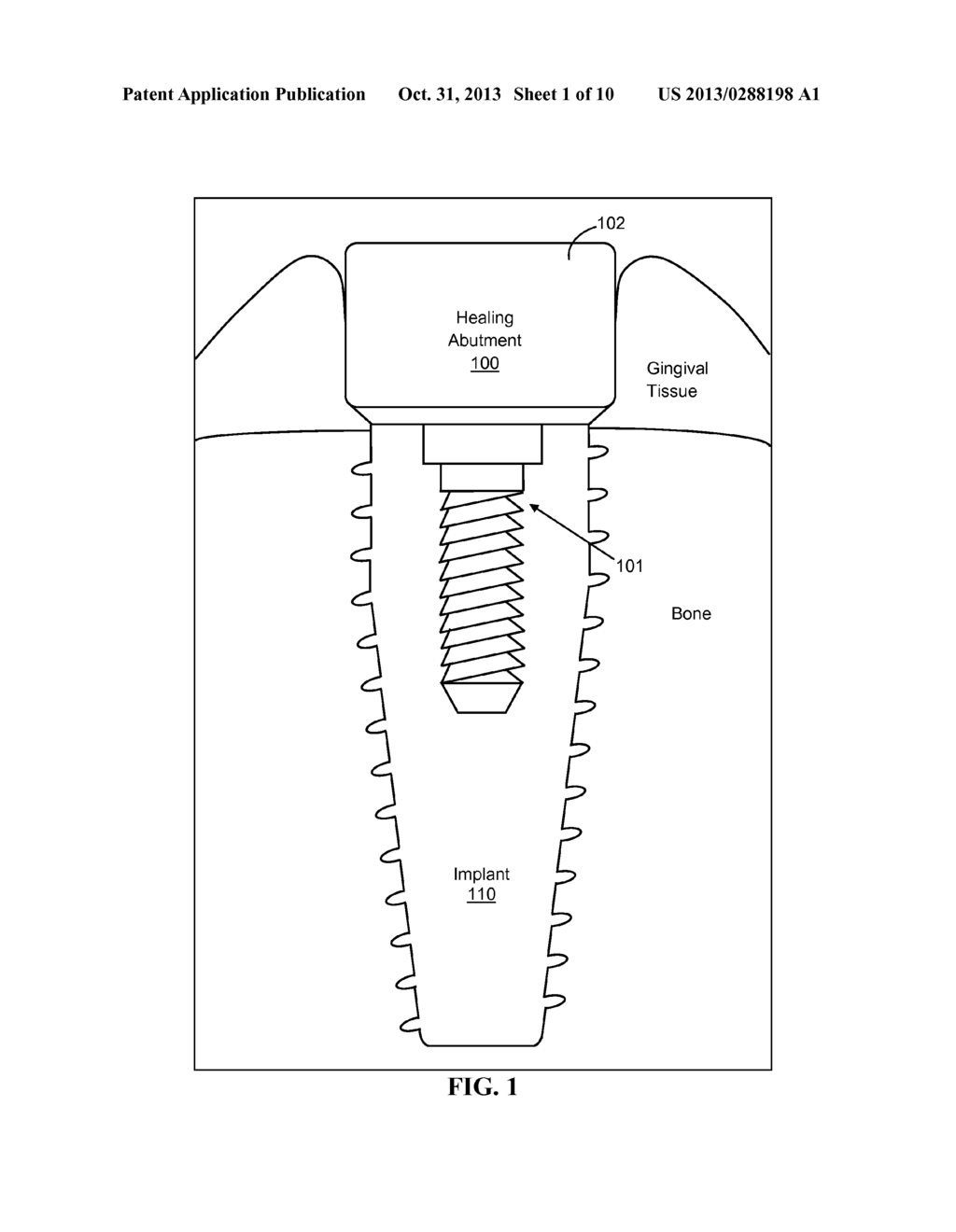 HEALING ABUTMENT AND FINAL ABUTMENT FOR USE WITH DENTAL IMPLANT - diagram, schematic, and image 02