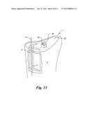 Simulant with Vascular Element Mechanically Responsive to a Tourniquet diagram and image