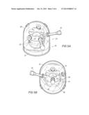 SURGICAL SIMULATION DEVICE AND ASSEMBLY diagram and image