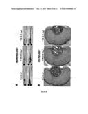 ANTI-ANGIOGENIC COMPOUND diagram and image