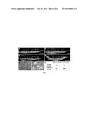 CHEMICAL INHIBITORS OF CHOLESTEROL BIOSYNTHESIS AND VENOUS ANGIOGENESIS diagram and image