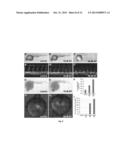 CHEMICAL INHIBITORS OF CHOLESTEROL BIOSYNTHESIS AND VENOUS ANGIOGENESIS diagram and image