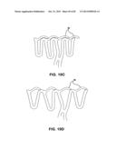 Bioabsorbable Polymeric Compositions and Medical Devices diagram and image