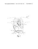 NON-INVASIVE DIAGNOSTICS FOR VENTRICLE ASSIST DEVICE diagram and image