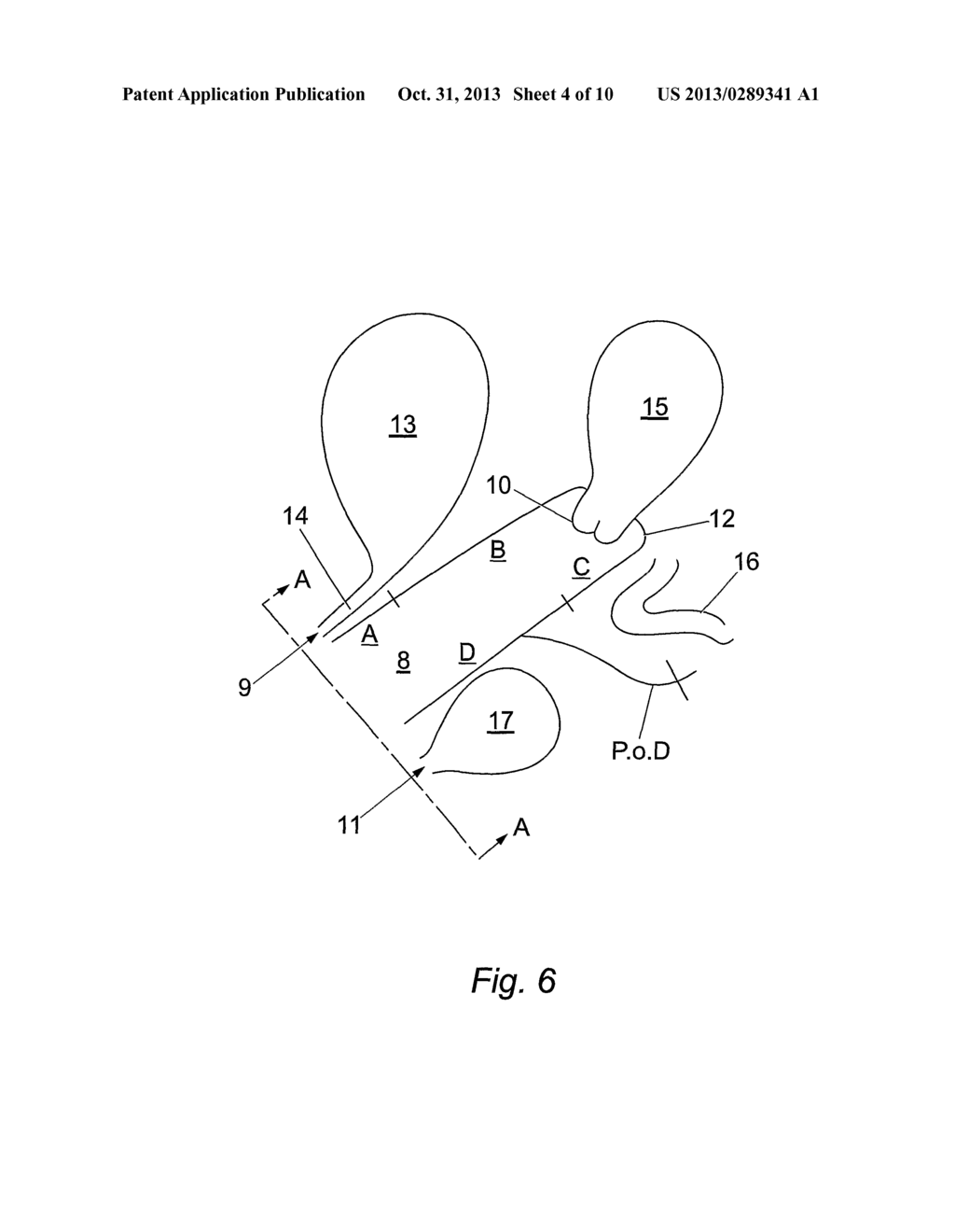 LOW MASS DENSITY SURGICAL IMPLANT AND METHODS OF USE - diagram, schematic, and image 05