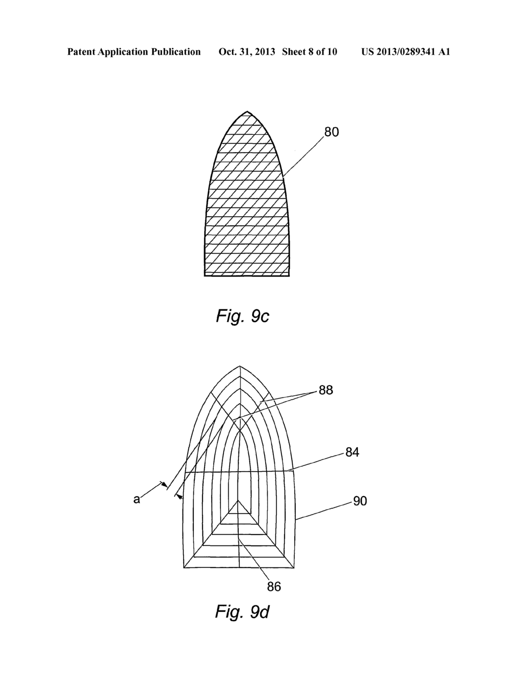 LOW MASS DENSITY SURGICAL IMPLANT AND METHODS OF USE - diagram, schematic, and image 09