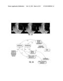 METHOD FOR DIAGNOSING THE FUNCTIONOF INTRINSIC SPHINCTERS diagram and image