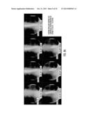 METHOD FOR DIAGNOSING THE FUNCTIONOF INTRINSIC SPHINCTERS diagram and image