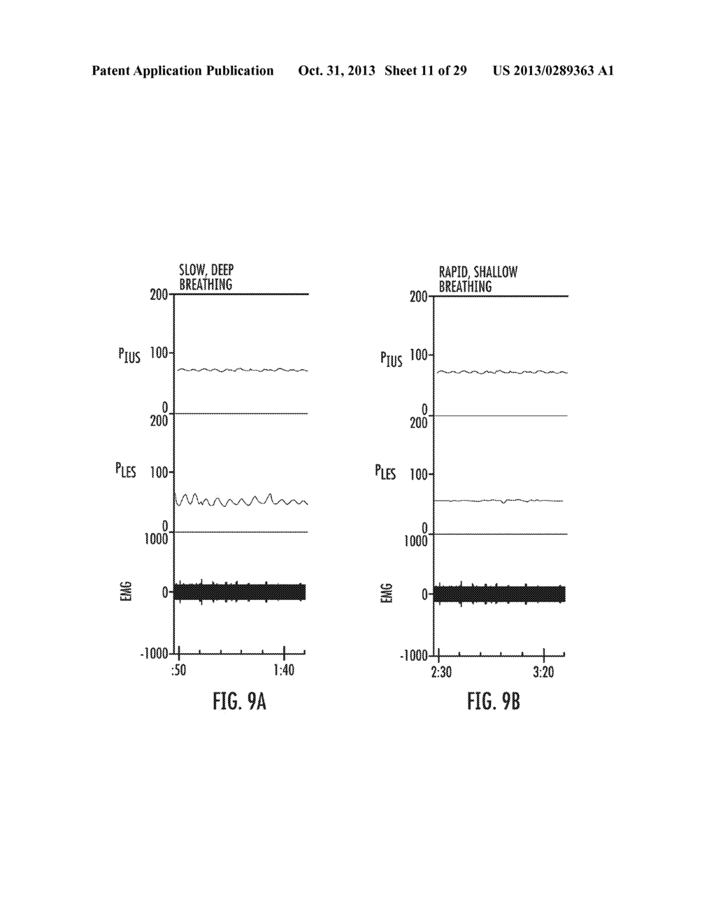 METHOD FOR DIAGNOSING THE FUNCTIONOF INTRINSIC SPHINCTERS - diagram, schematic, and image 12