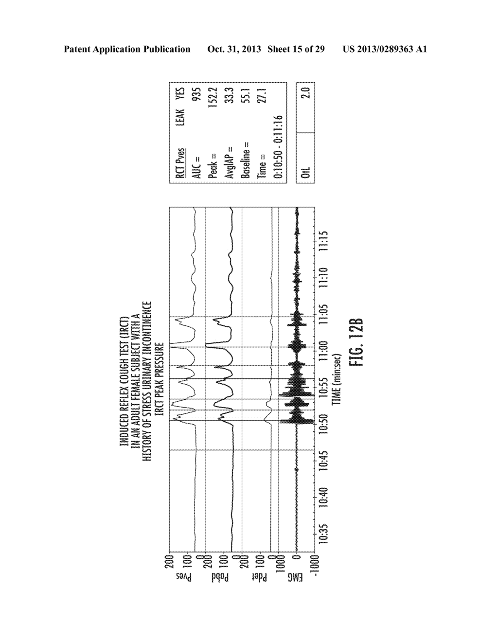 METHOD FOR DIAGNOSING THE FUNCTIONOF INTRINSIC SPHINCTERS - diagram, schematic, and image 16