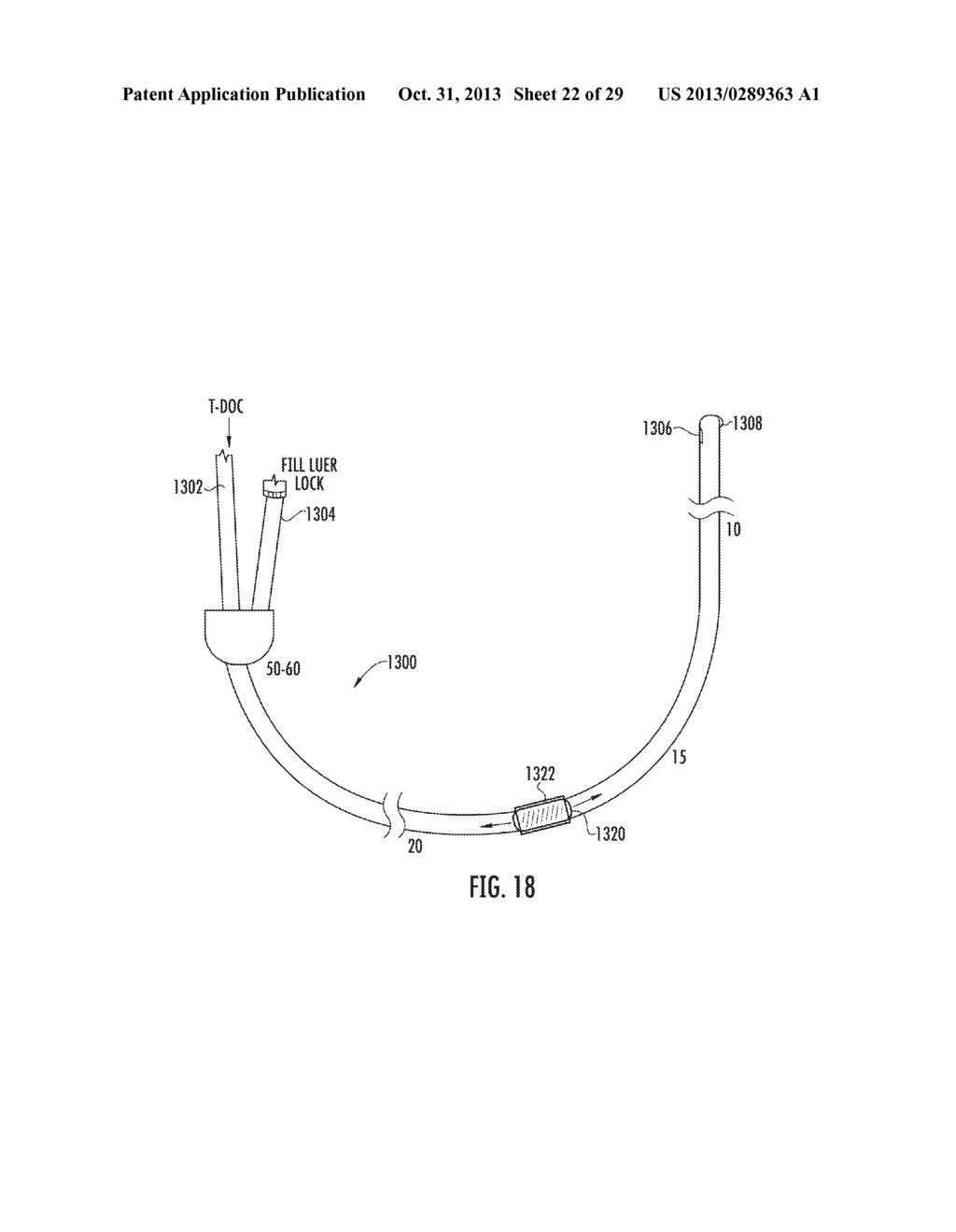 METHOD FOR DIAGNOSING THE FUNCTIONOF INTRINSIC SPHINCTERS - diagram, schematic, and image 23