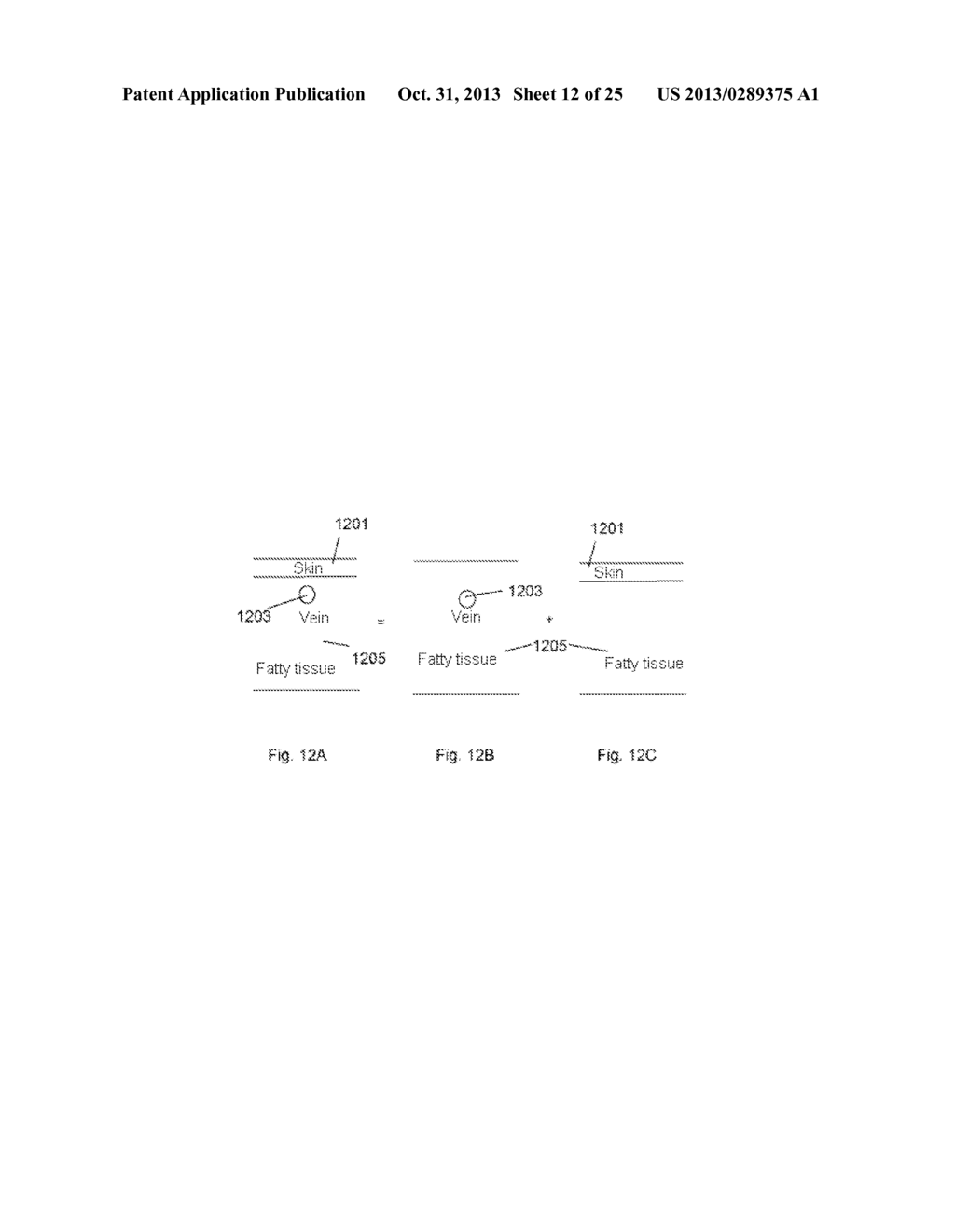 Armband for a Detection Device for the Detection of a Blood Count     Parameter - diagram, schematic, and image 13