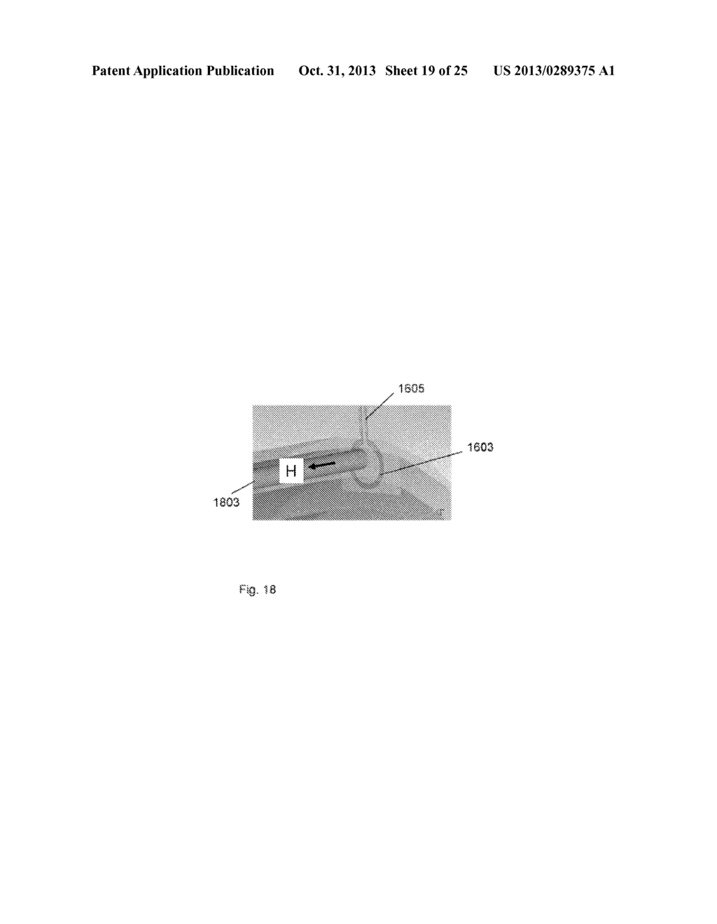 Armband for a Detection Device for the Detection of a Blood Count     Parameter - diagram, schematic, and image 20