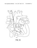 METHOD AND APPARATUS FOR CARDIAC FUNCTION MONITORING diagram and image