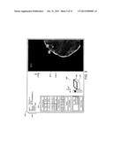 ADJUNCTIVE ULTRASOUND PROCESSING AND DISPLAY FOR BREAST CANCER SCREENING diagram and image