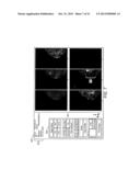 ADJUNCTIVE ULTRASOUND PROCESSING AND DISPLAY FOR BREAST CANCER SCREENING diagram and image