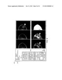 ADJUNCTIVE ULTRASOUND PROCESSING AND DISPLAY FOR BREAST CANCER SCREENING diagram and image