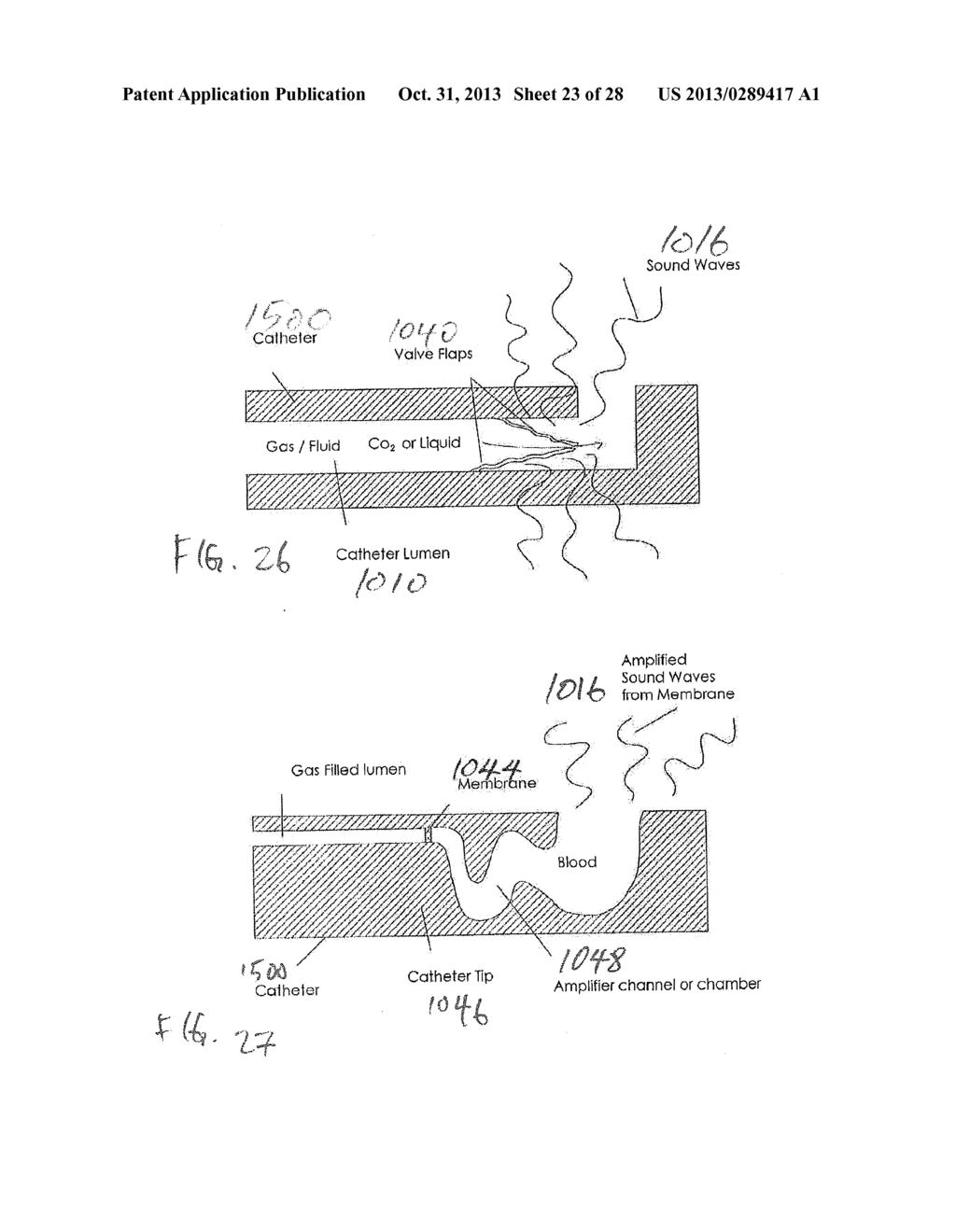 APPARATUS AND METHOD FOR ENDOVASCULAR DEVICE GUIDING AND POSITIONING USING     PHYSIOLOGICAL PARAMETERS - diagram, schematic, and image 24