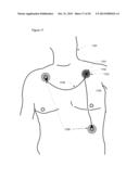 SYSTEM FOR PROCESSING PHYSIOLOGICAL DATA diagram and image