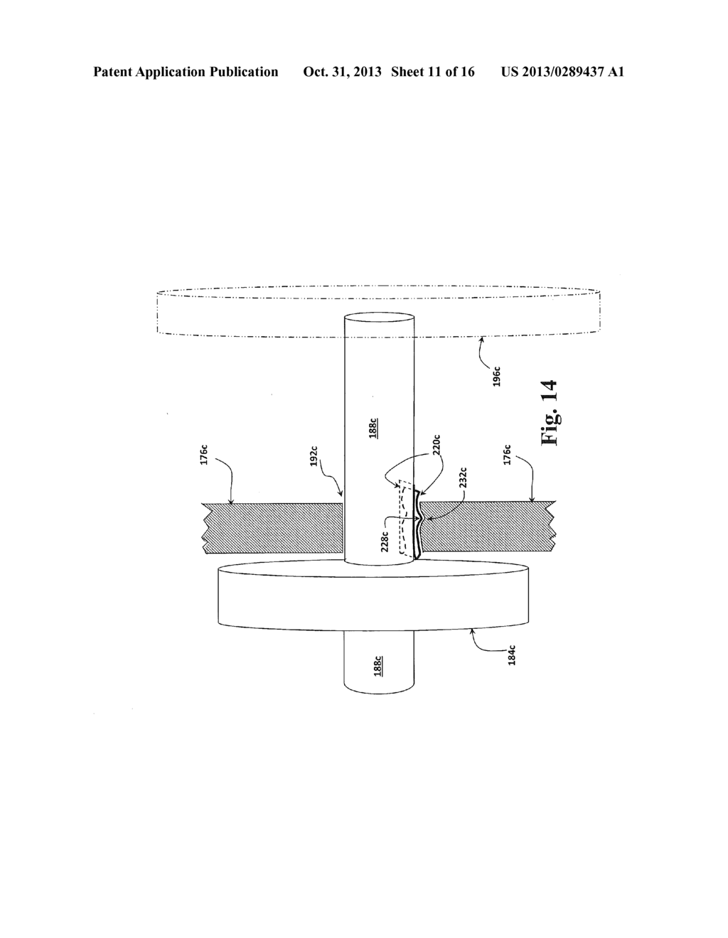 Method for Measuring a Bulbocavernosus Reflex - diagram, schematic, and image 12