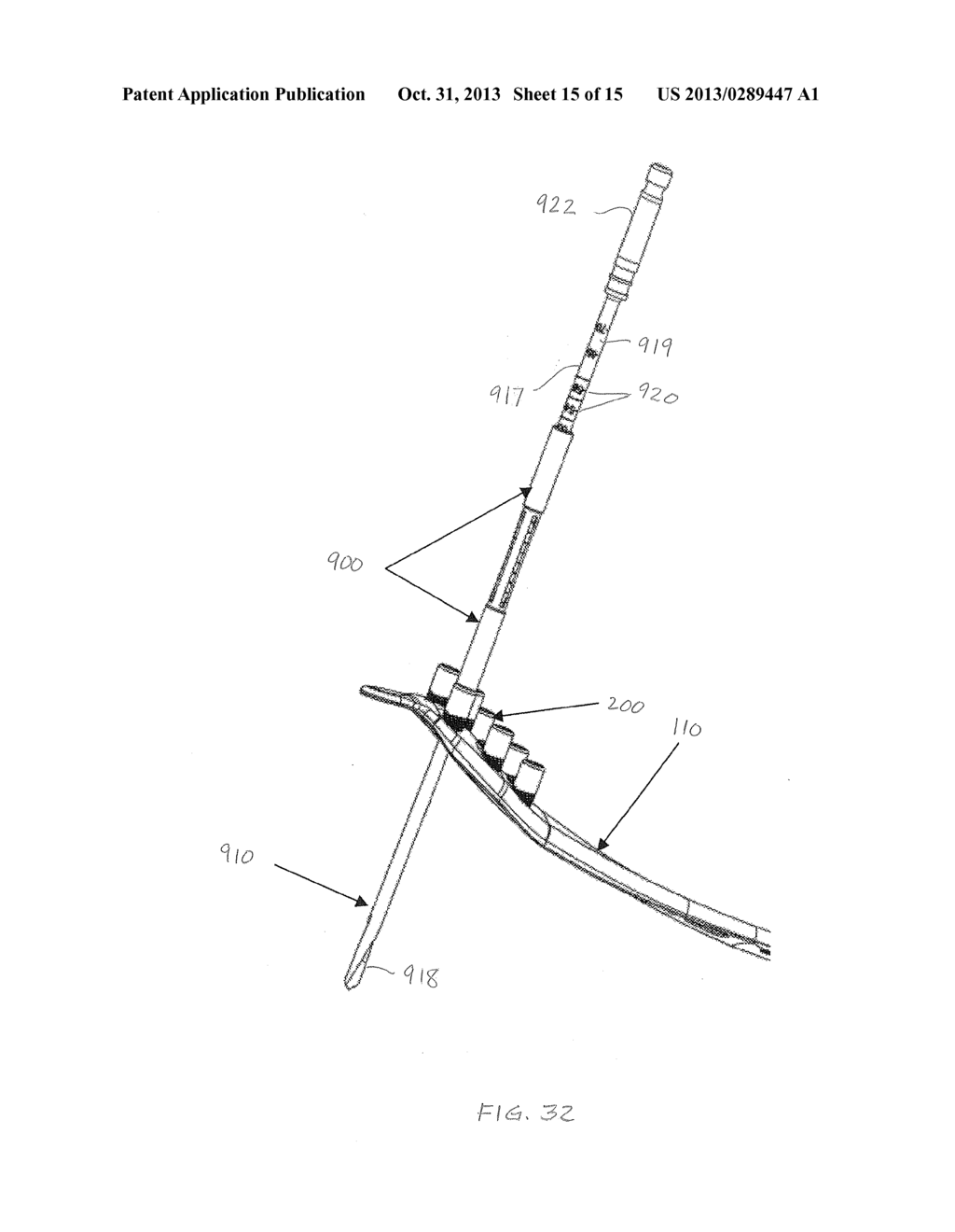 Method of Using a Drill Sleeve (as amended) - diagram, schematic, and image 16