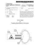 Method for Laser Treatment for Glaucoma diagram and image