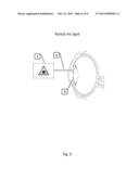 Method for Laser Treatment for Glaucoma diagram and image