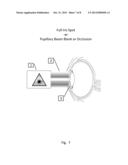 Method for Laser Treatment for Glaucoma diagram and image