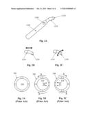 Infusion Sleeve With Motion Reduction Profile diagram and image