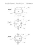 Infusion Sleeve With Motion Reduction Profile diagram and image