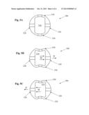 Infusion Sleeve With Motion Reduction Profile diagram and image