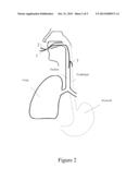 Medical Conduit diagram and image