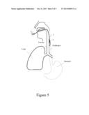 Medical Conduit diagram and image