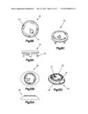 SYSTEMS AND METHODS FOR REMOVING INGESTED MATERIAL FROM A STOMACH diagram and image