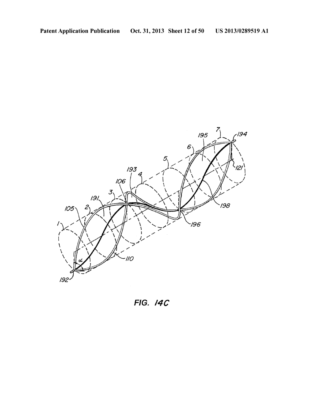 METHODS FOR MAINTAINING A FILTERING DEVICE WITHIN A LUMEN - diagram, schematic, and image 13