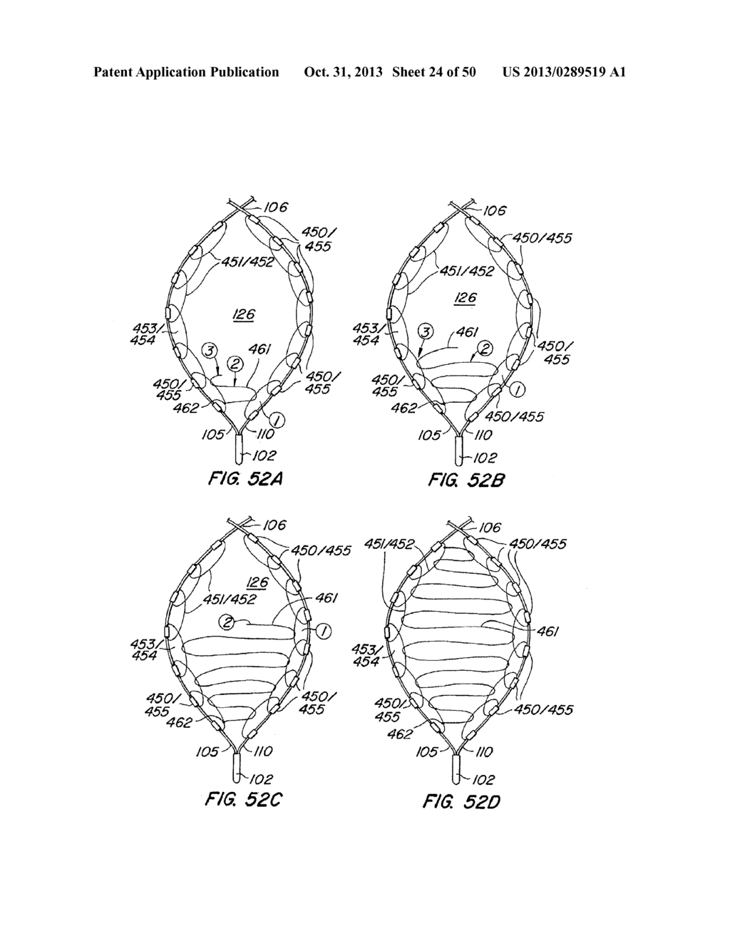 METHODS FOR MAINTAINING A FILTERING DEVICE WITHIN A LUMEN - diagram, schematic, and image 25