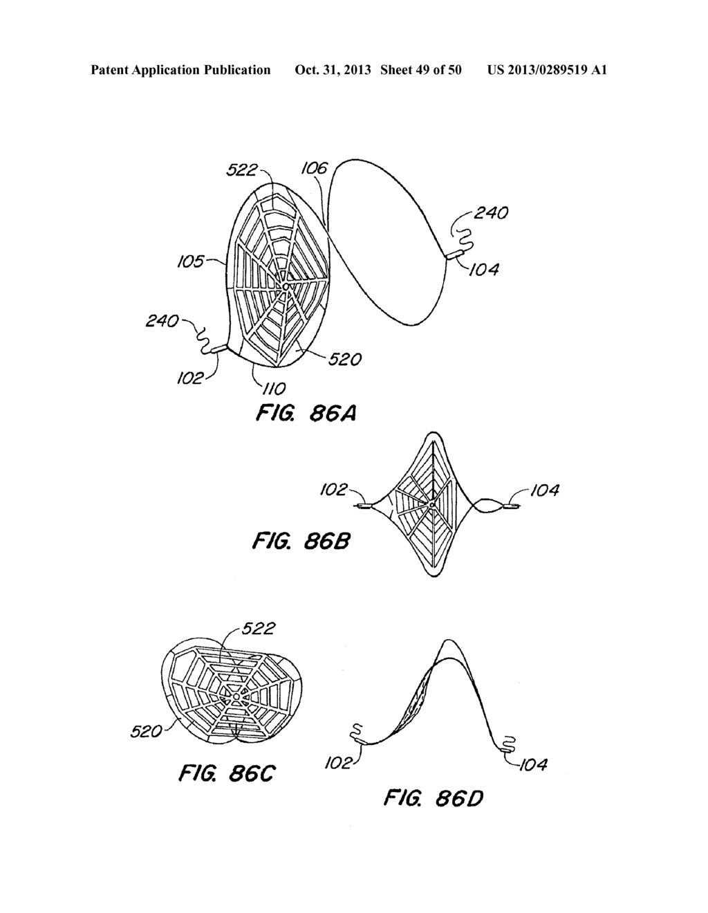 METHODS FOR MAINTAINING A FILTERING DEVICE WITHIN A LUMEN - diagram, schematic, and image 50