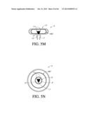 IMPLANT WITH HIGH VAPOR PRESSURE MEDIUM diagram and image