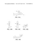 IMPLANT WITH HIGH VAPOR PRESSURE MEDIUM diagram and image