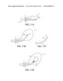 IMPLANT WITH HIGH VAPOR PRESSURE MEDIUM diagram and image