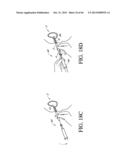 IMPLANT WITH HIGH VAPOR PRESSURE MEDIUM diagram and image