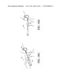 IMPLANT WITH HIGH VAPOR PRESSURE MEDIUM diagram and image