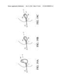 IMPLANT WITH HIGH VAPOR PRESSURE MEDIUM diagram and image