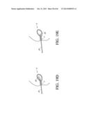 IMPLANT WITH HIGH VAPOR PRESSURE MEDIUM diagram and image